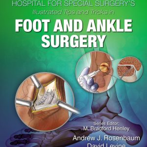 Hospital for Special Surgerys Illustrated Tips and Tricks in Foot and Ankle Surgery