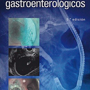 Manual de procedimientos gastroenterológicos (Spanish Edition)