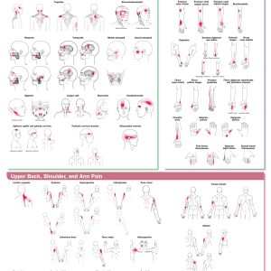 Travell, Simons & Simons’ Trigger Point Pain Patterns Wall Chart: Head, Neck, and Upper Limb