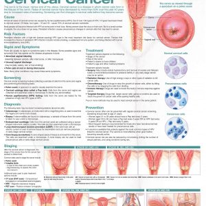 Understanding Cervical Cancer Anatomical Chart