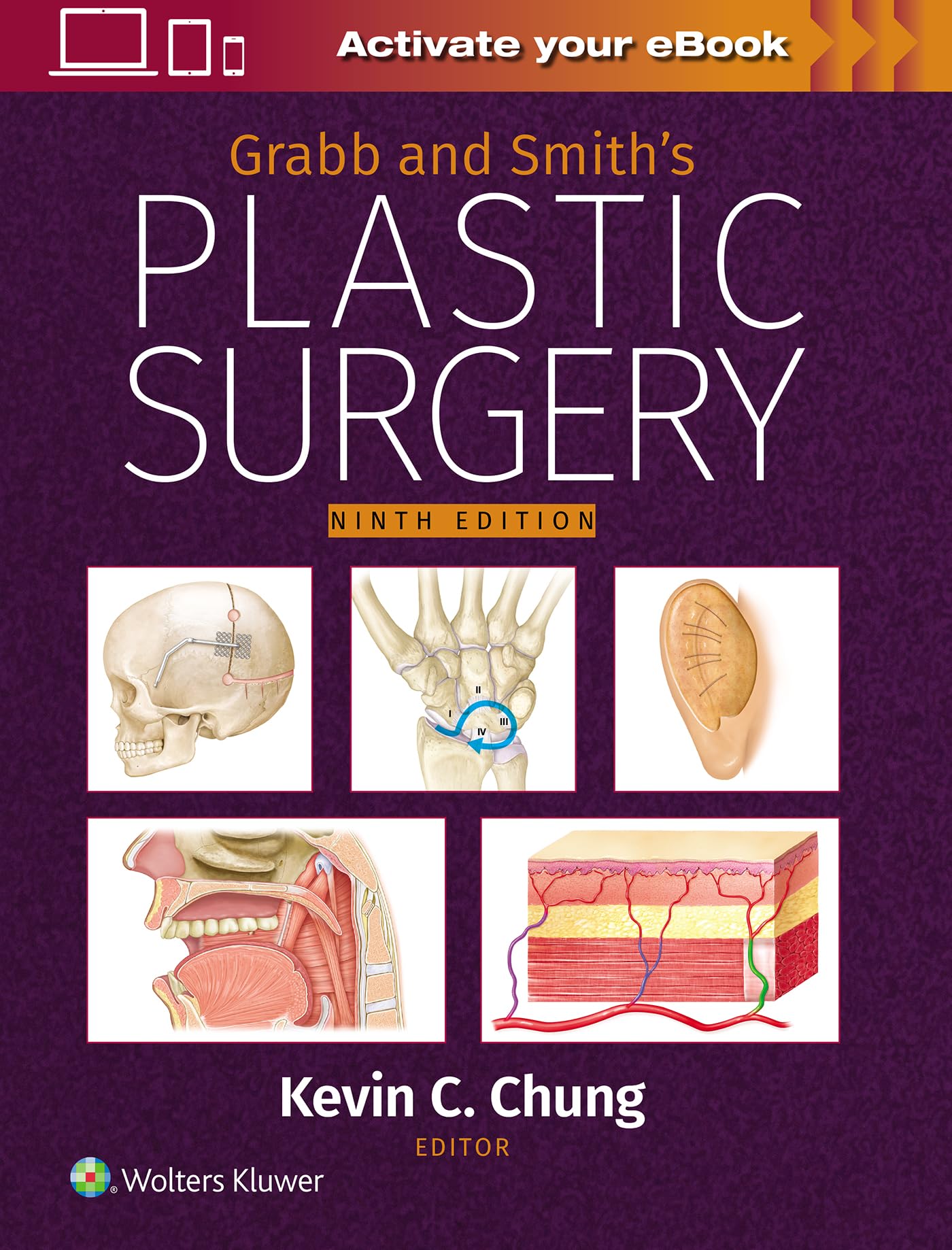Grabb and Smiths Plastic Surgery: Print + eBook with Multimedia