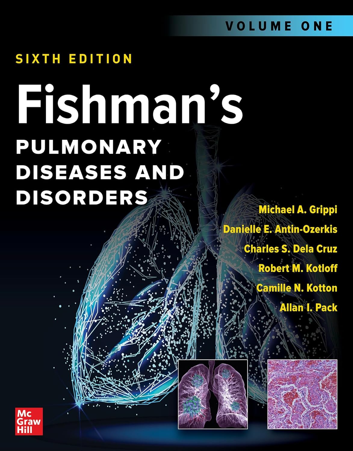 Fishman's Pulmonary Diseases and Disorders