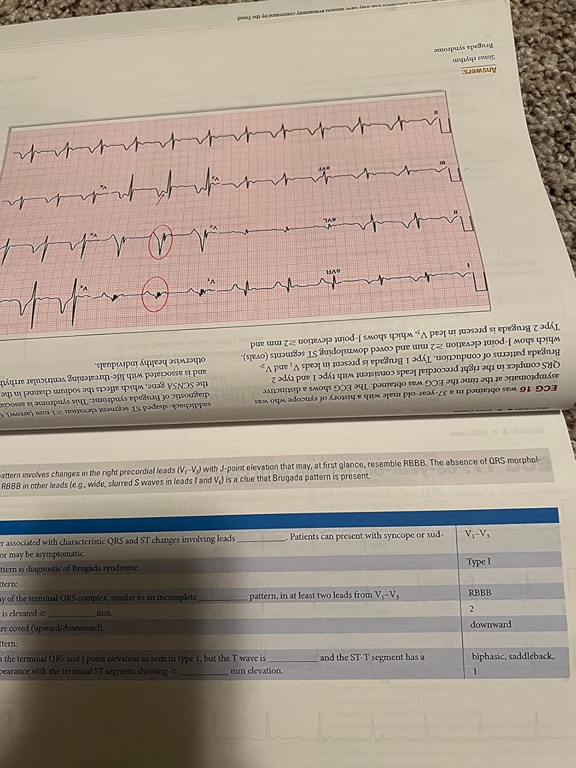 The Complete Guide to ECGs: A Comprehensive Study Guide to Improve ECG Interpretation Skills: A Comprehensive Study Guide to Improve ECG Interpretation Skills 5th Edition 9781284199055 - Image 7