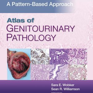 Atlas of Genitourinary Pathology: A Pattern Based Approach