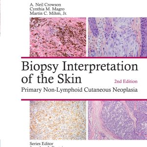 Biopsy Interpretation of the Skin: Primary Non-Lymphoid Cutaneous Neoplasia