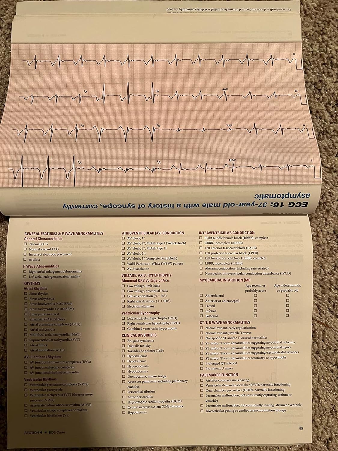 The Complete Guide to ECGs: A Comprehensive Study Guide to Improve ECG Interpretation Skills: A Comprehensive Study Guide to Improve ECG Interpretation Skills 5th Edition 9781284199055 - Image 8