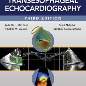 Clinical Manual and Review of Transesophageal Echocardiography