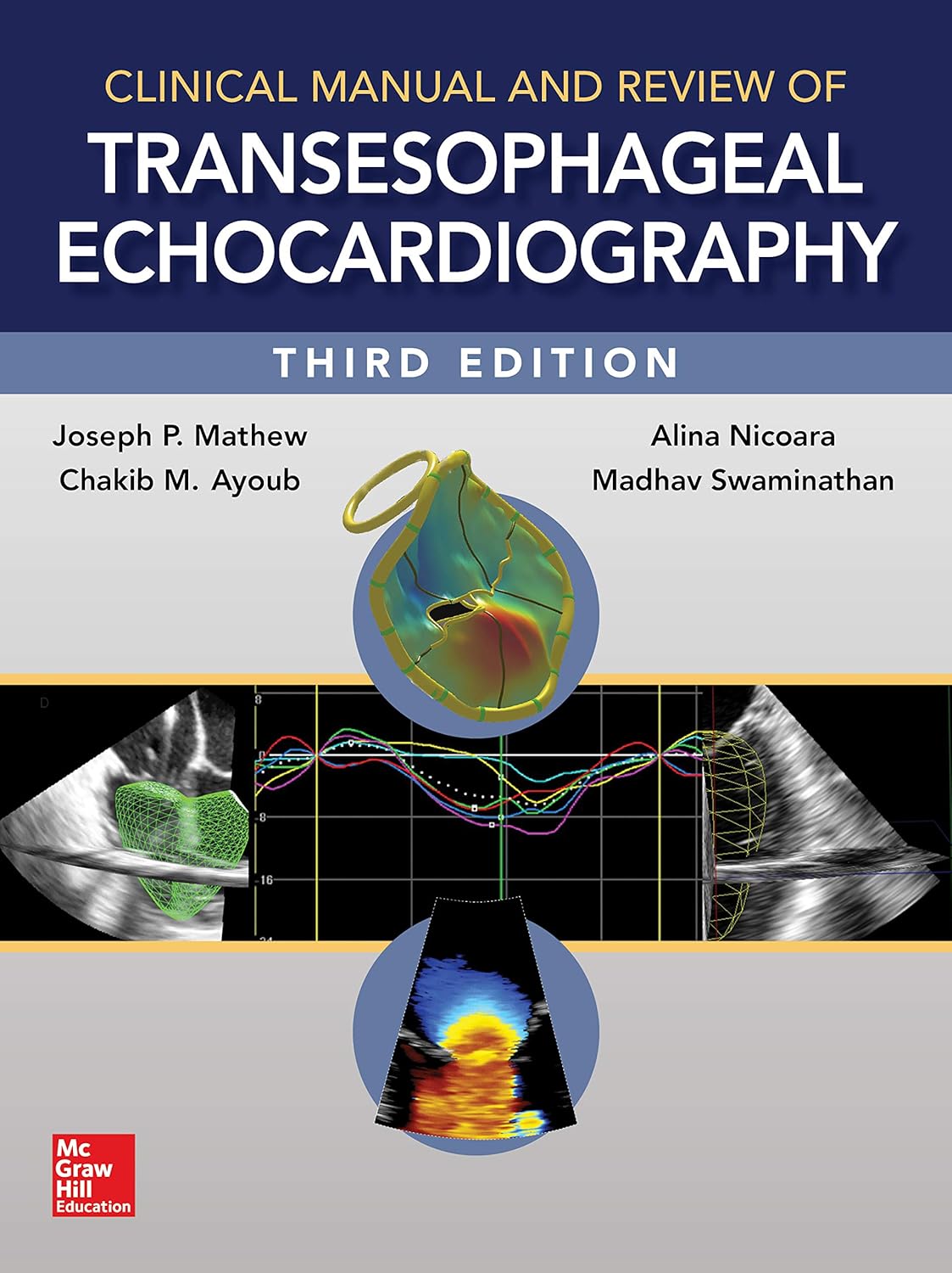 Clinical Manual and Review of Transesophageal Echocardiography