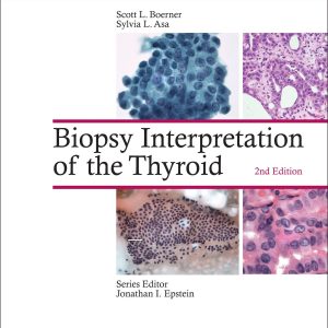 Biopsy Interpretation of the Thyroid
