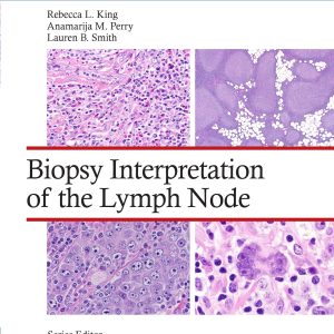 Biopsy Interpretation of the Lymph Node: Print + eBook with Multimedia