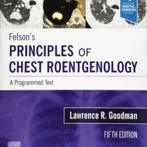 Felson's Principles of Chest Roentgenology