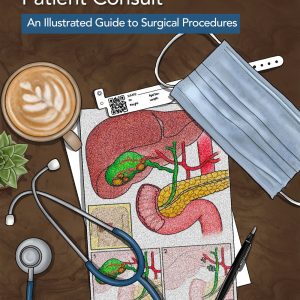 Visual Aid for Perioperative Patient Consult: An Illustrated Guide to Surgical Procedures