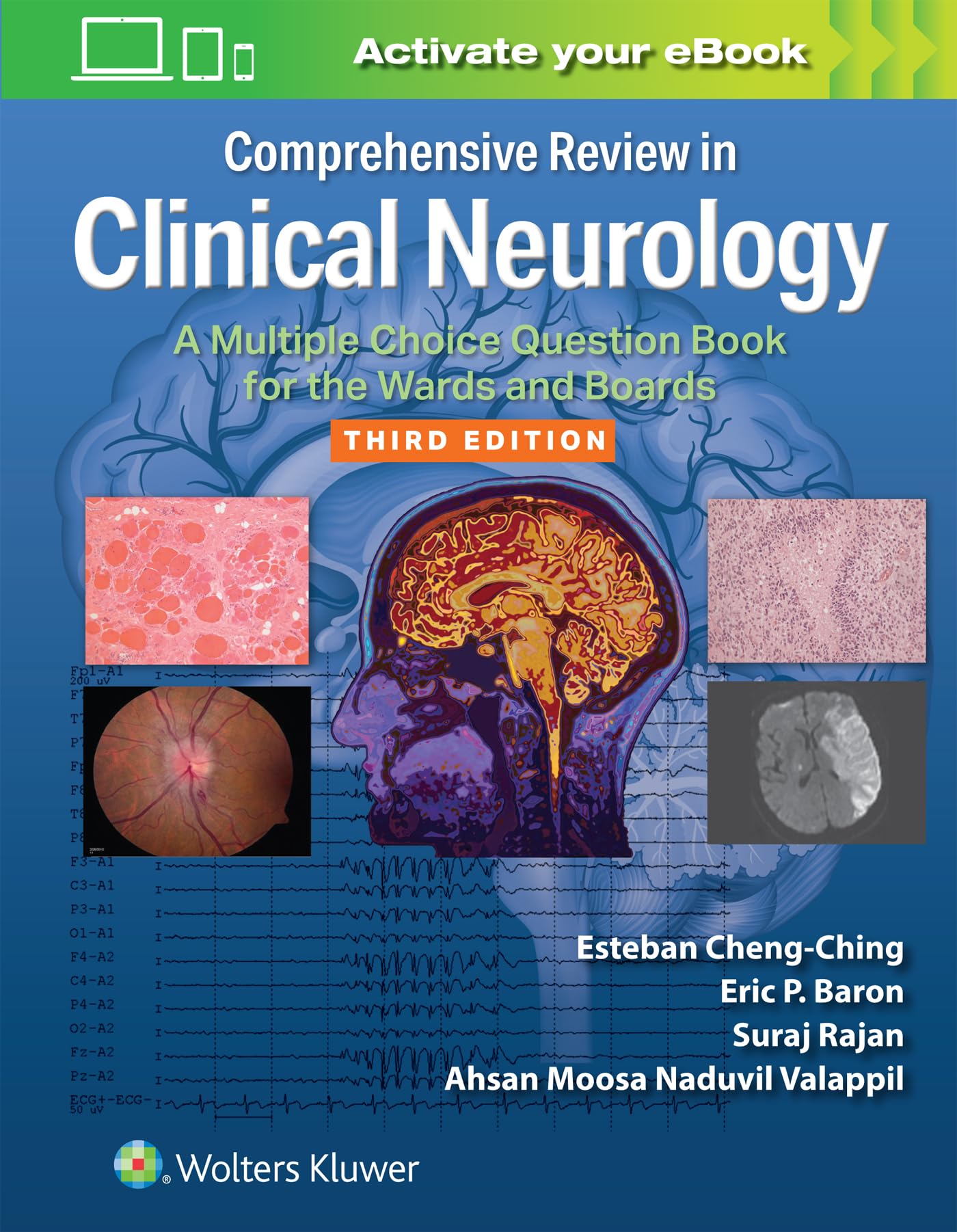 Comprehensive Review in Clinical Neurology: A Multiple Choice Question Book for the Wards and Boards Print + Ebook with Multimedia