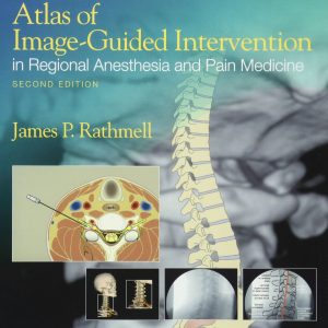 Atlas of Image-Guided Intervention in Regional Anesthesia and Pain Medicine
