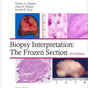 Biopsy Interpretation: The Frozen Section: Print + eBook with Multimedia