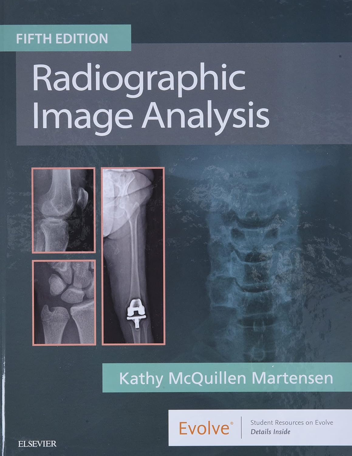 Radiographic Image Analysis 5th Edition 9780323522816