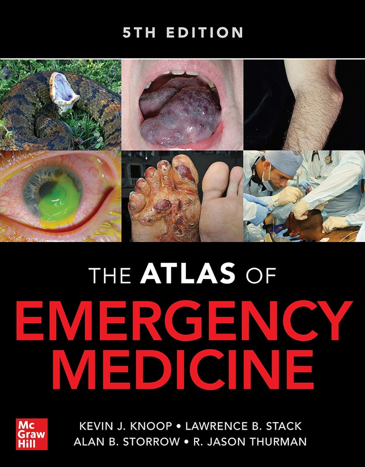 Atlas of Emergency Medicine 5th Edition 5th Edition 9781260134940