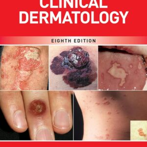 Fitzpatrick's Color Atlas AND SYNOPSIS OF CLINICAL DERMATOLOGY
