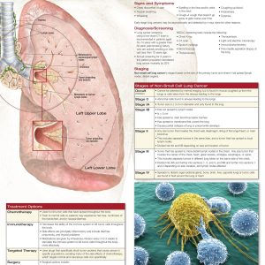 Non-Small Cell Lung Cancer