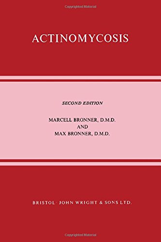 Actinomycosis