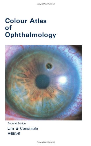 Colour Atlas of Ophthalmology