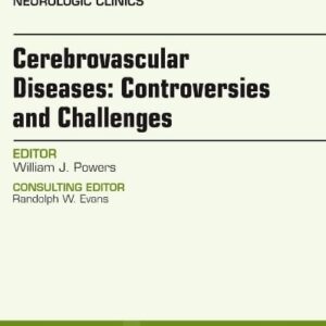 Cerebrovascular Diseases: Controversies and Challenges