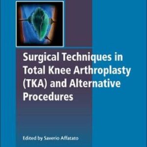 Surgical Techniques in Total Knee Arthroplasty and Alternative Procedures (Woodhead Publishing Series in Biomaterials)