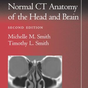 Pocket Atlas of Normal CT Anatomy of the Head and Brain (Radiology Pocket Atlas Series)-ISBN: 9780781729499