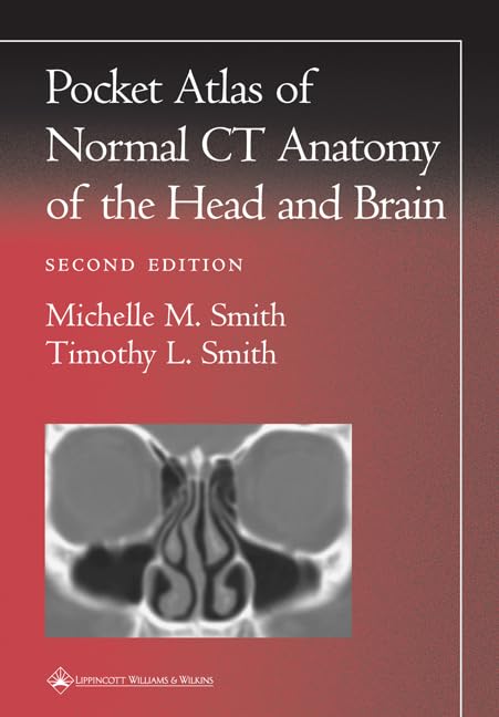 Pocket Atlas of Normal CT Anatomy of the Head and Brain (Radiology Pocket Atlas Series)-ISBN: 9780781729499