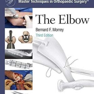 Master Techniques in Orthopaedic Surgery: The Elbow-ISBN: 1451173091