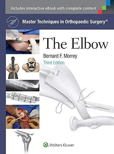 Master Techniques in Orthopaedic Surgery: The Elbow-ISBN: 1451173091