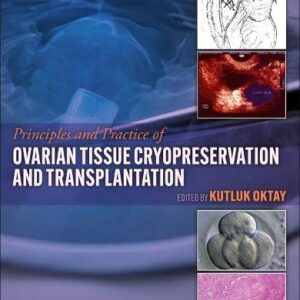 Principles and Practice of Ovarian Tissue Cryopreservation and Transplantation