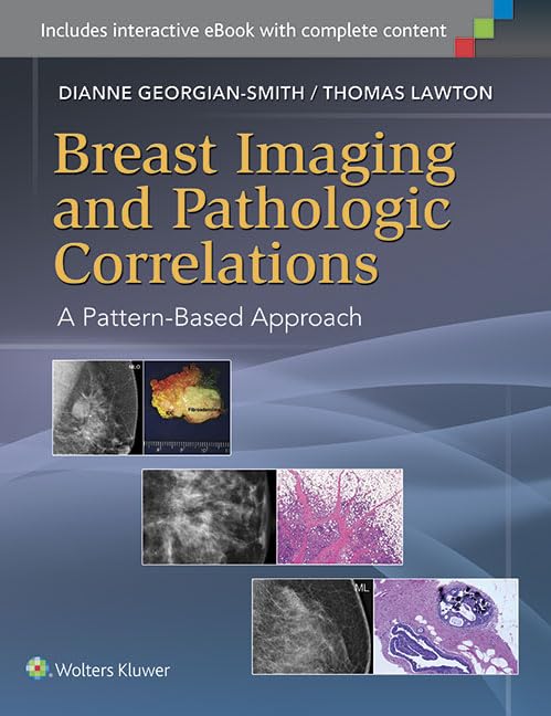 Breast Imaging and Pathologic Correlations: A Pattern-Based Approach-ISBN: 9781451192698