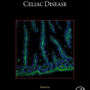 Celiac Disease (Volume 179) (Methods in Cell Biology