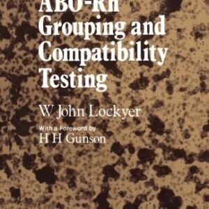 Essentials of ABO -Rh Grouping and Compatibility Testing: Theoretical Aspects and Practical Application