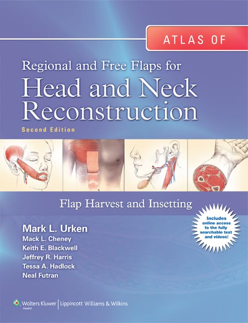 Atlas of Regional and Free Flaps for Head and Neck Reconstruction: Flap Harvest and Insetting-ISBN: 9781605479729
