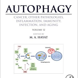 Autophagy: Cancer