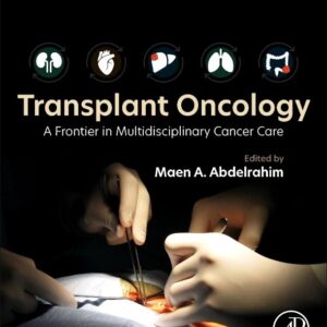 Transplant Oncology: A Frontier in Multidisciplinary Cancer Care
