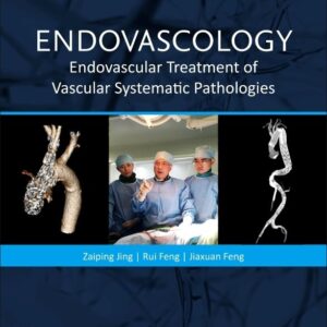 Endovascology: Endovascular Treatment of Vascular Systematic Pathologies