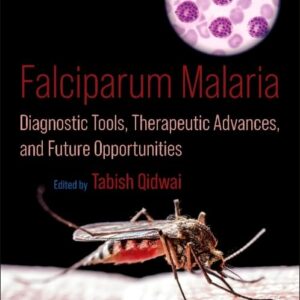 Falciparum Malaria: Diagnostic Tools