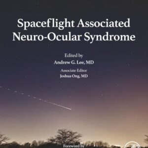 Spaceflight Associated Neuro-Ocular Syndrome