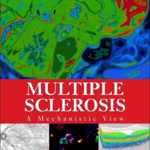 Multiple Sclerosis: A Mechanistic View