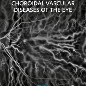 Retinal and Choroidal Vascular Diseases of the Eye