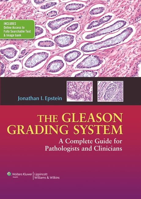 The Gleason Grading System: A Complete Guide for Pathologist and Clinicians-ISBN: 9781451172829