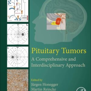 Pituitary Tumors: A Comprehensive and Interdisciplinary Approach