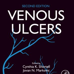 Venous Ulcers
