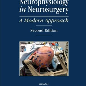 Neurophysiology in Neurosurgery: A Modern Approach