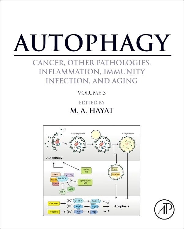 Autophagy: Cancer