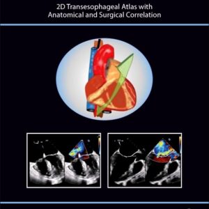 The Art of 2D Transesophageal Echocardiography: 2D Transesophageal Atlas with Anatomical and Surgical Correlation