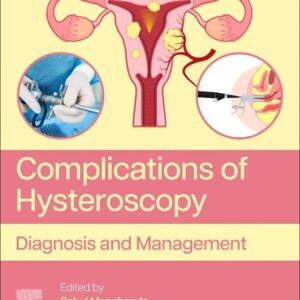 Complications of Hysteroscopy: Diagnosis and Management